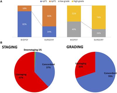 Evaluation of Pre-operative Biopsy, Surgical Procedures and Oncologic Outcomes in Upper Tract Urothelial Carcinoma (UTUC)